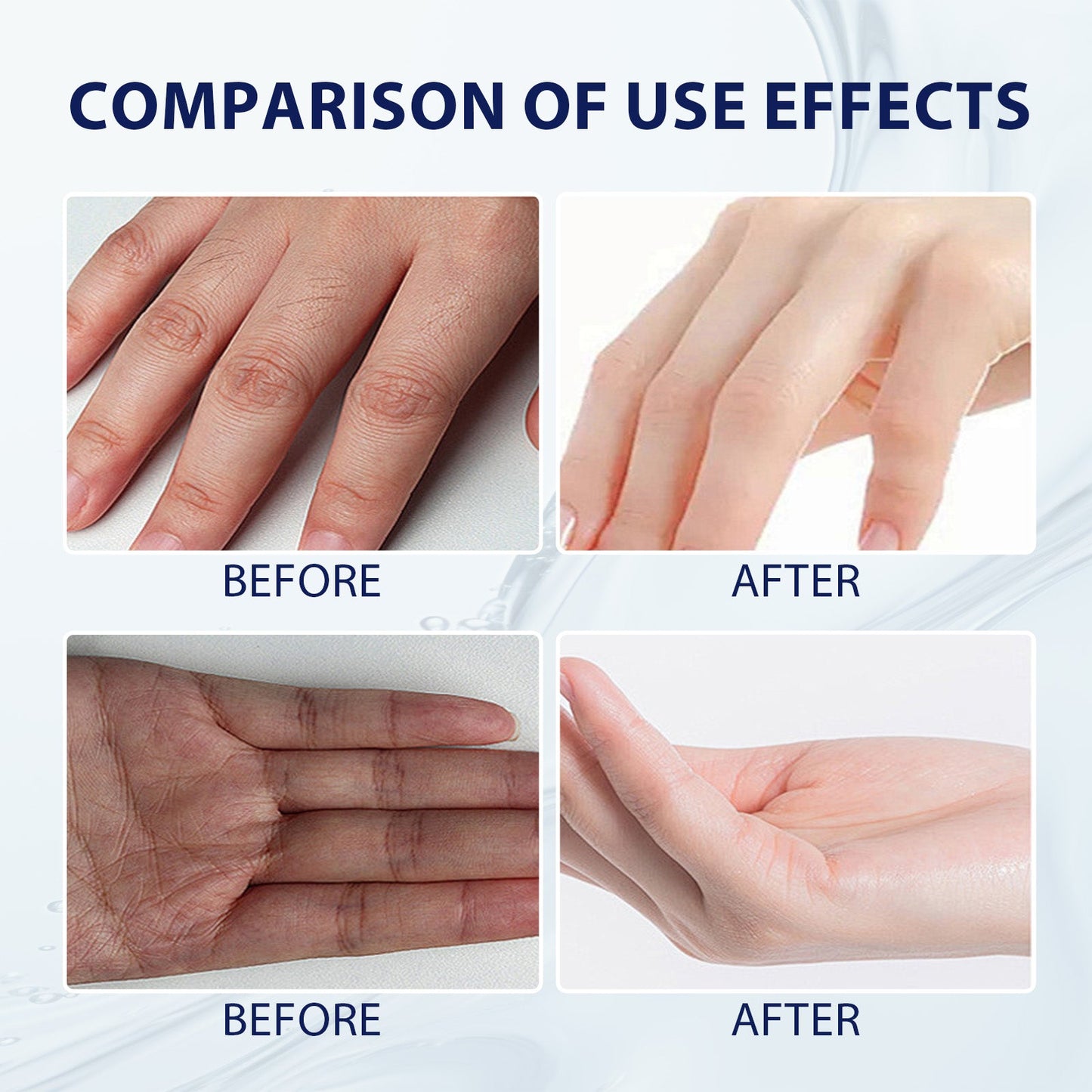 Aloe Vera Care Gel, Hydrating And Refreshing Moisturizing Cream Prevents Dryness And Cracks To Repair Hand Skin