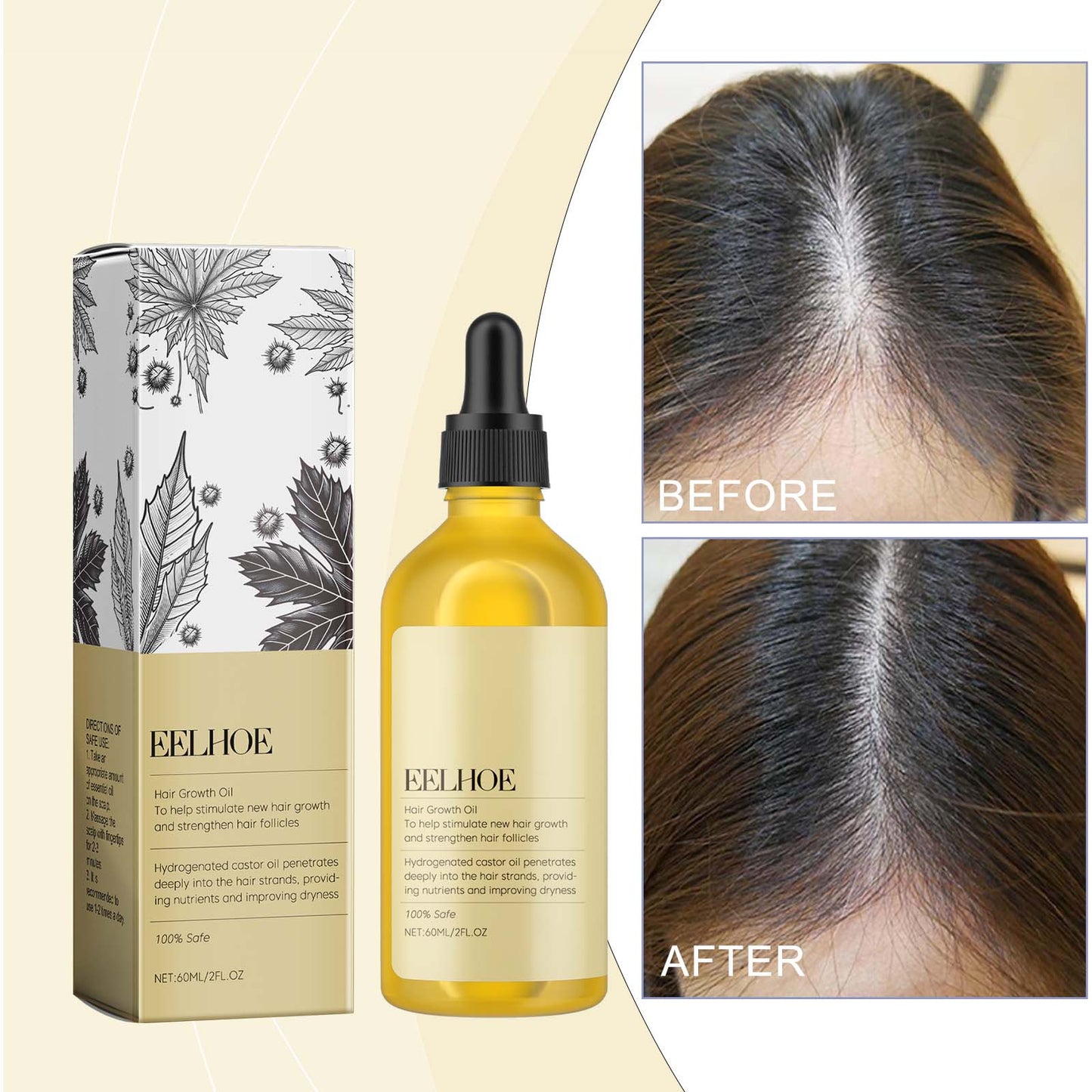 Castor Dense Hair Essential Oil Repair Dry And Damaged Scalp Hair Moist, Hydrating And Smoothing Hair