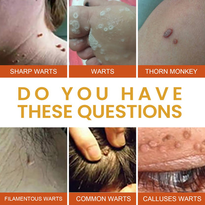 Anti-wart Essence, Anti Warts Fade Moles Corns Smoothing Skin Care Essence