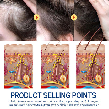 Hair Scrub Cleans Scalp Dandruff, Soothes Itchiness, Moisturizes Dense, Firming, And Prevents Hair Loss