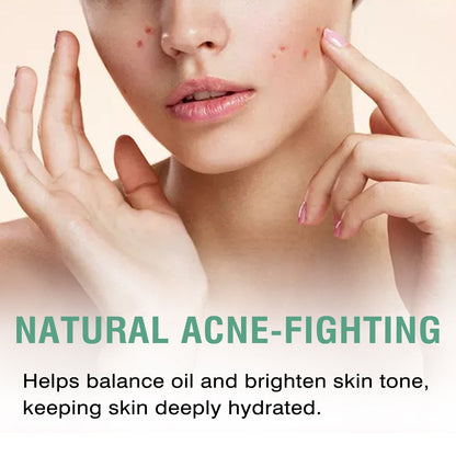 Green Tea Moisturizing Toner, Skin Tender Shine Clean Blain Mark Clear Water Not Greasy Toner
