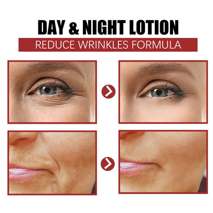 Retinol Series, Lift And Tighten The Skin, Reduce Fine Lines, Eye Lines Repair Facial Skin