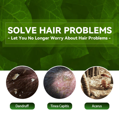 Tinea Capitis Anti-Itch Shampoo Anti-Drop Refreshing Oil Control Hair Care Anti-Dandruff Anti-Itch Shampoo