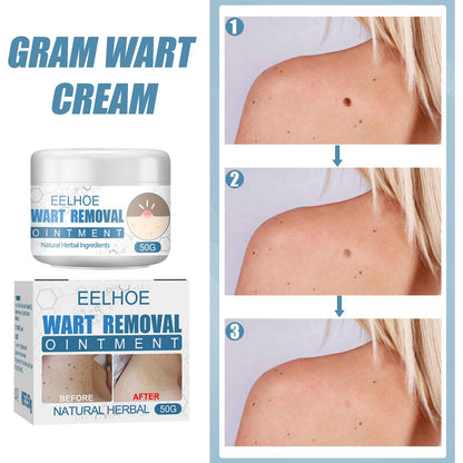 Wart Cream, Skin Clean And Smooth Wart Nevi Facial Care Cream