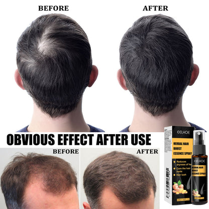 Herbal Hair Essence Spray,Prevent Falling Hair And Scalp Moisturizing And Nourishing Solution