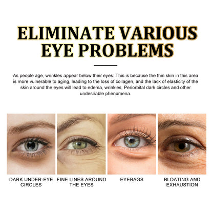 Gold Snail Collagen Eye Mask, Reduces Fine Lines And Puffiness, Hydrates Tightens And Anti-wrinkle Eye Mask