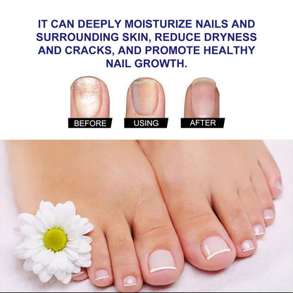 Plant Drops, Repair Extremities Soft Thickening Light Armour Moist Clean Fingernails Detailer