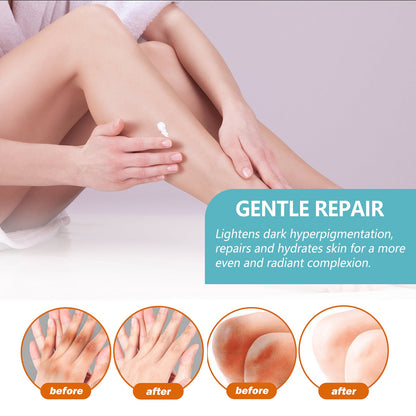 Black Acanthoderm Repair Cream Repair Underarm Arm Knee Joint Black Moisturizing Whitening Body Care Cream