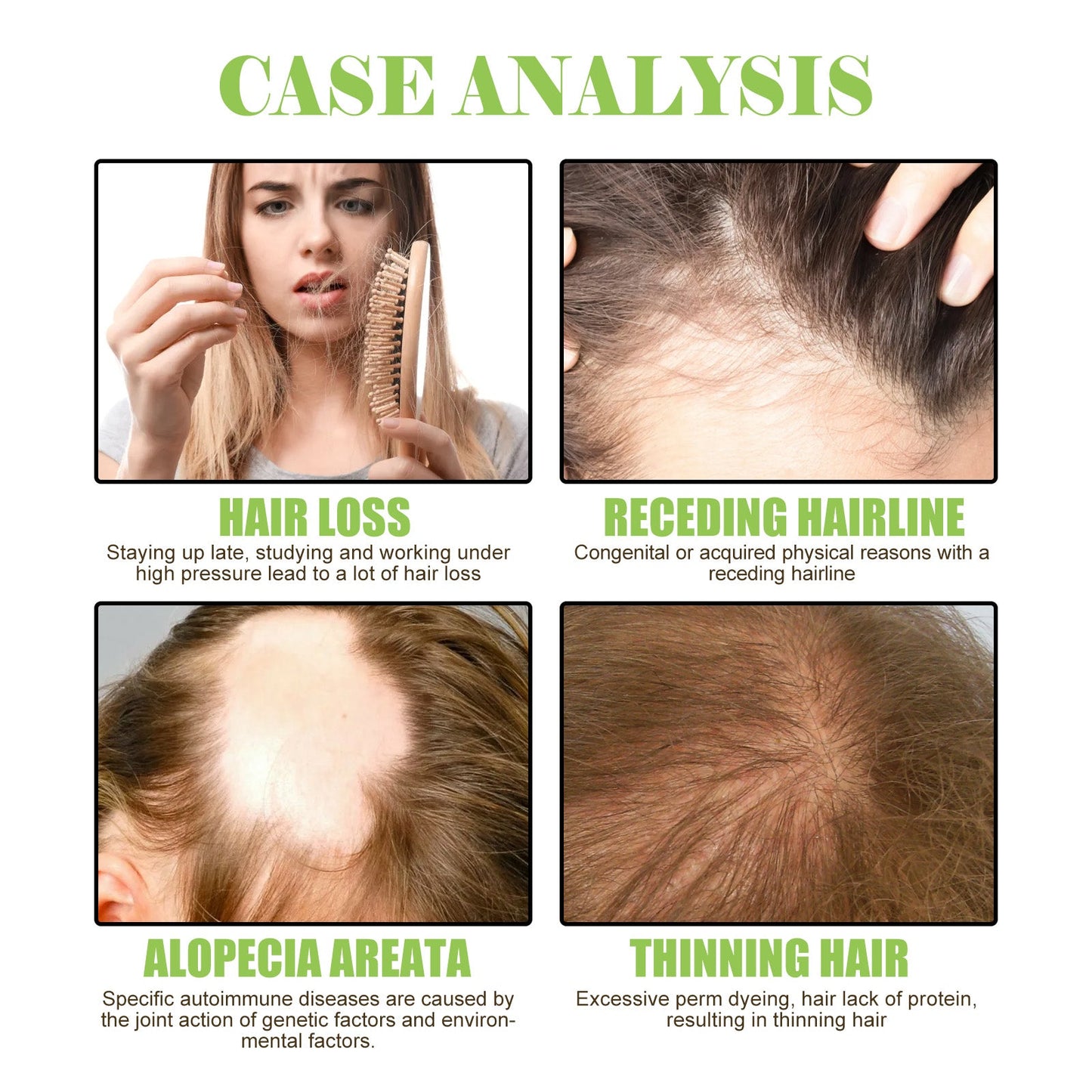 Ginger Care Shampoo Scalp Cleansing, Anti-Break Nourishing Root Strengthening Shampoo