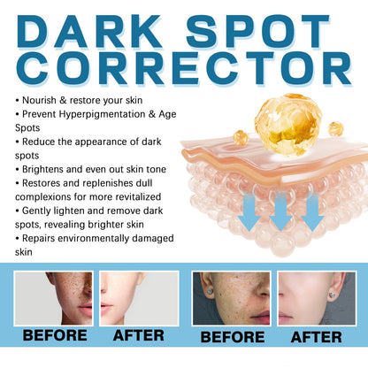 Dark Spot Lightening Cream Lightening Dark Spot Melasma Repairing Dull And Even Skin Tone Brightening Cream