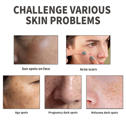 Dark Spot Serum, Fade Spot Moisturize Skin Repair Blain Mark Face Dull Shine Essence