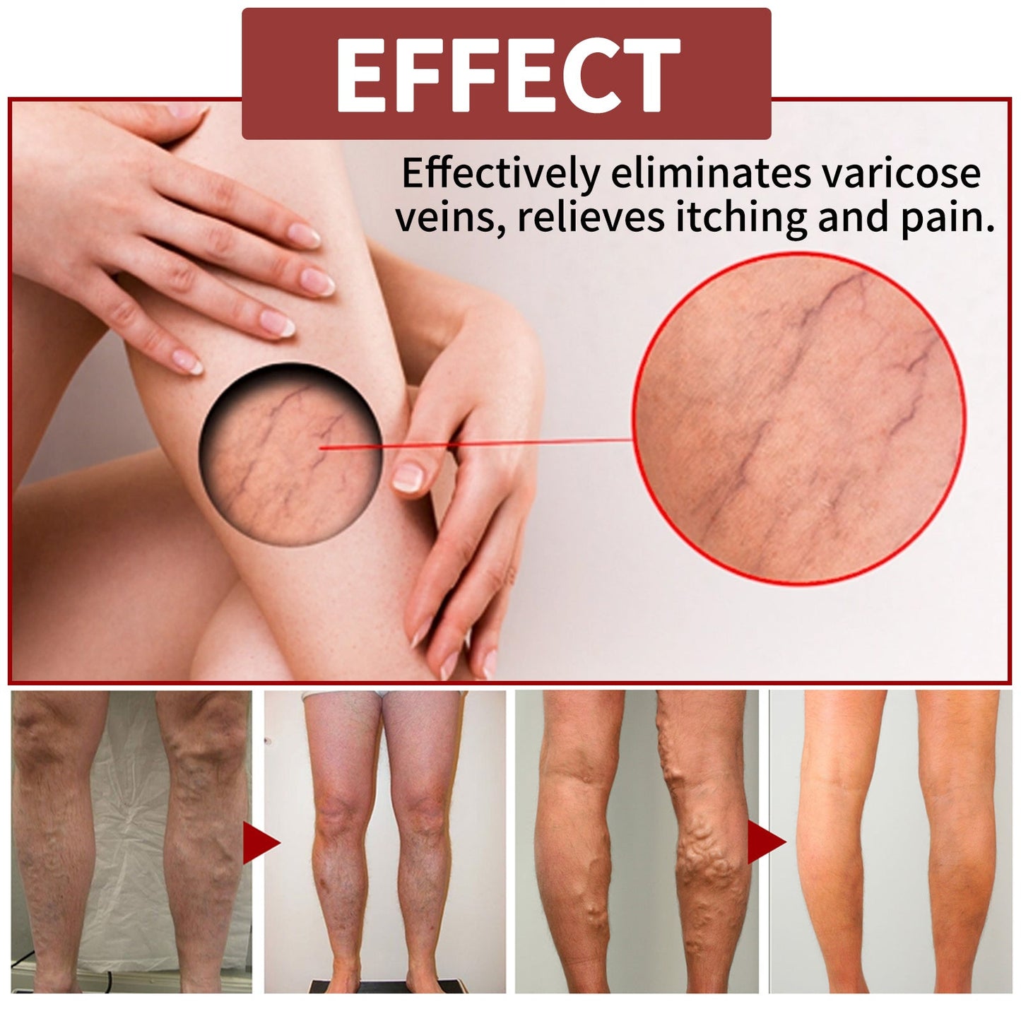 Venous Massage Varicose Cream, Relieves Bulging Leg Blood Vessels And Swollen Leg Earthworm Venous Massage Cream