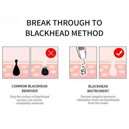 Blackhead Remover Face Deep Pore Cleaner Removal Vacuum Suction Facial SPA Diamond Beauty Care Tool Skin Care