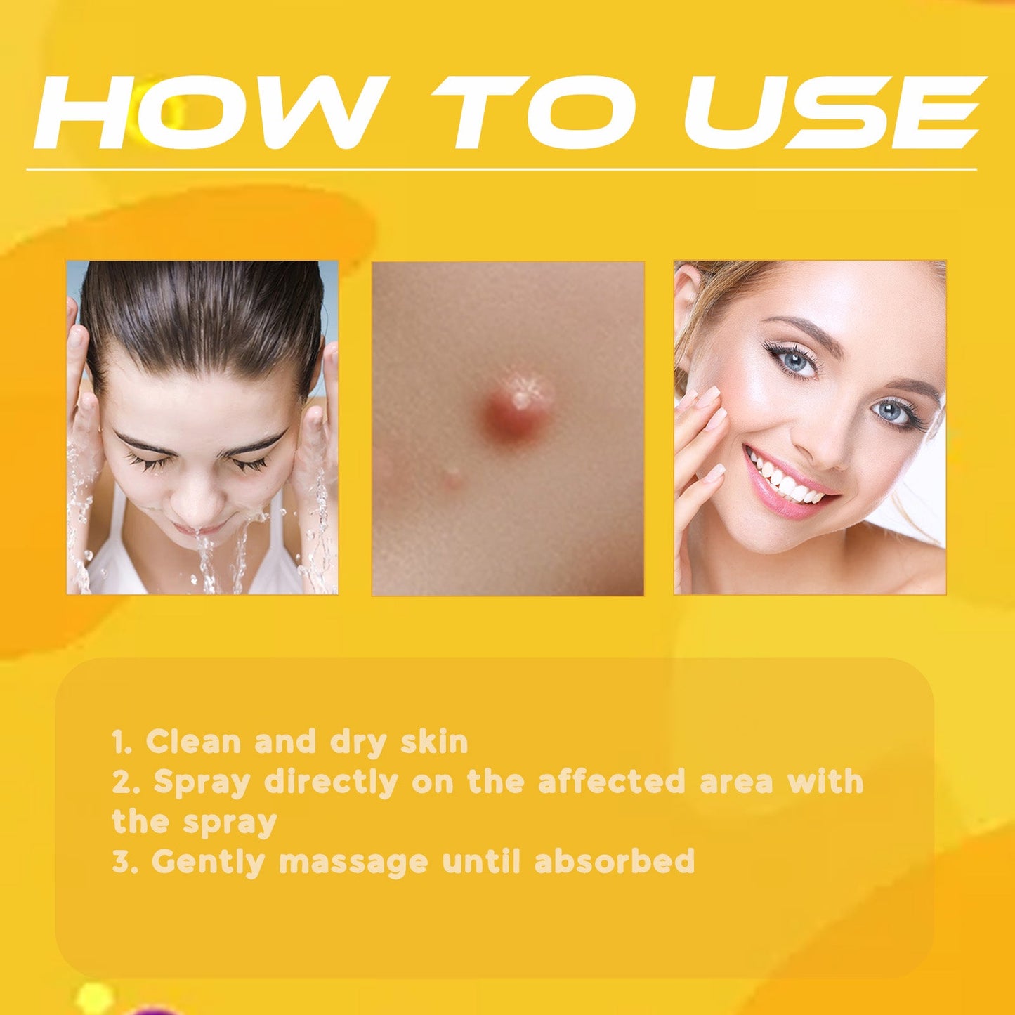 Bee Venom Wart Treatment Spray Improves Pimples, Moles, Repairs and Smooths Skin Wart Treatment Spray