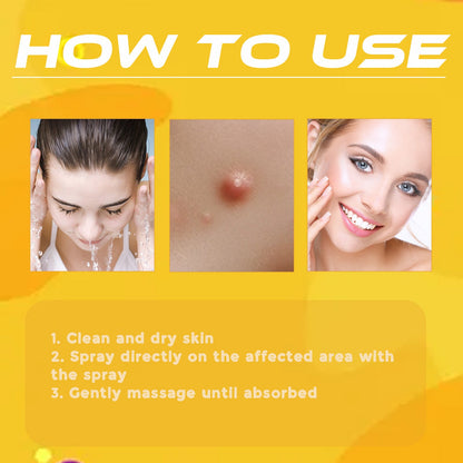 Bee Venom Wart Treatment Spray Improves Pimples, Moles, Repairs and Smooths Skin Wart Treatment Spray