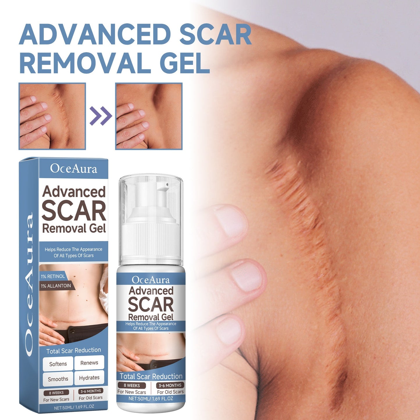 Oceaura Scar Whitening Repair Gel Moisturizes And Smooths Skin Repair Surgery Scar Pregnancy Care Gel