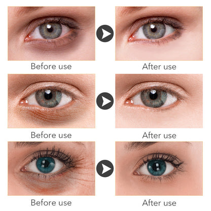 Eye Cream for Women, 30ml