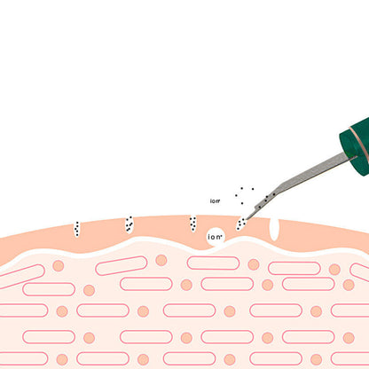 Ultrasonic Skin Rejuvenation Exfoliating Device