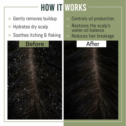MagiForet Anti-Dandruff Shampoo & Conditioner Set 2x500ml Dry Flaky Scalp