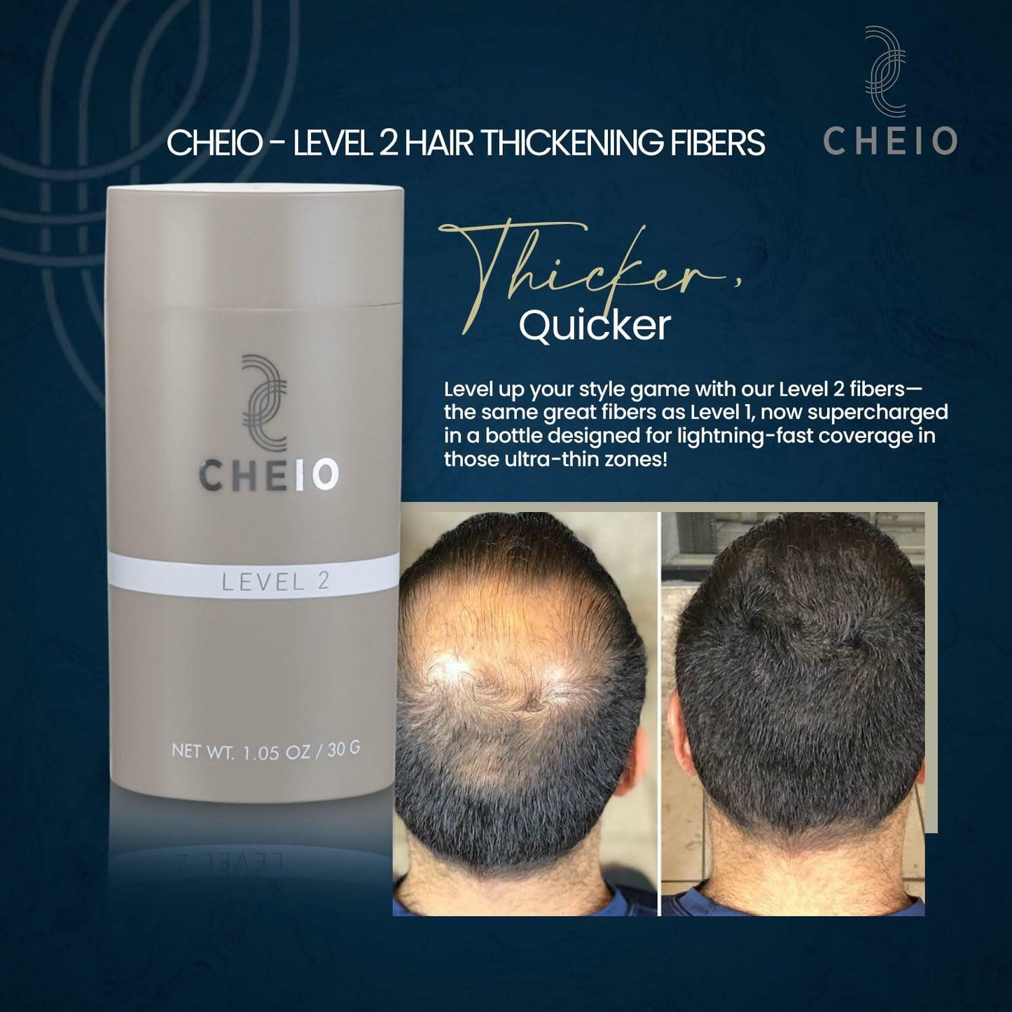 Cheio Hair Thickening Fibers Keratin Level 2 Light Brown 30g Bald Spots