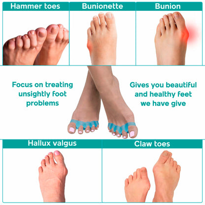 NAMELESS NICHE Toe Separators Bunion Corrector Toe Spacers Pink 1 Pair