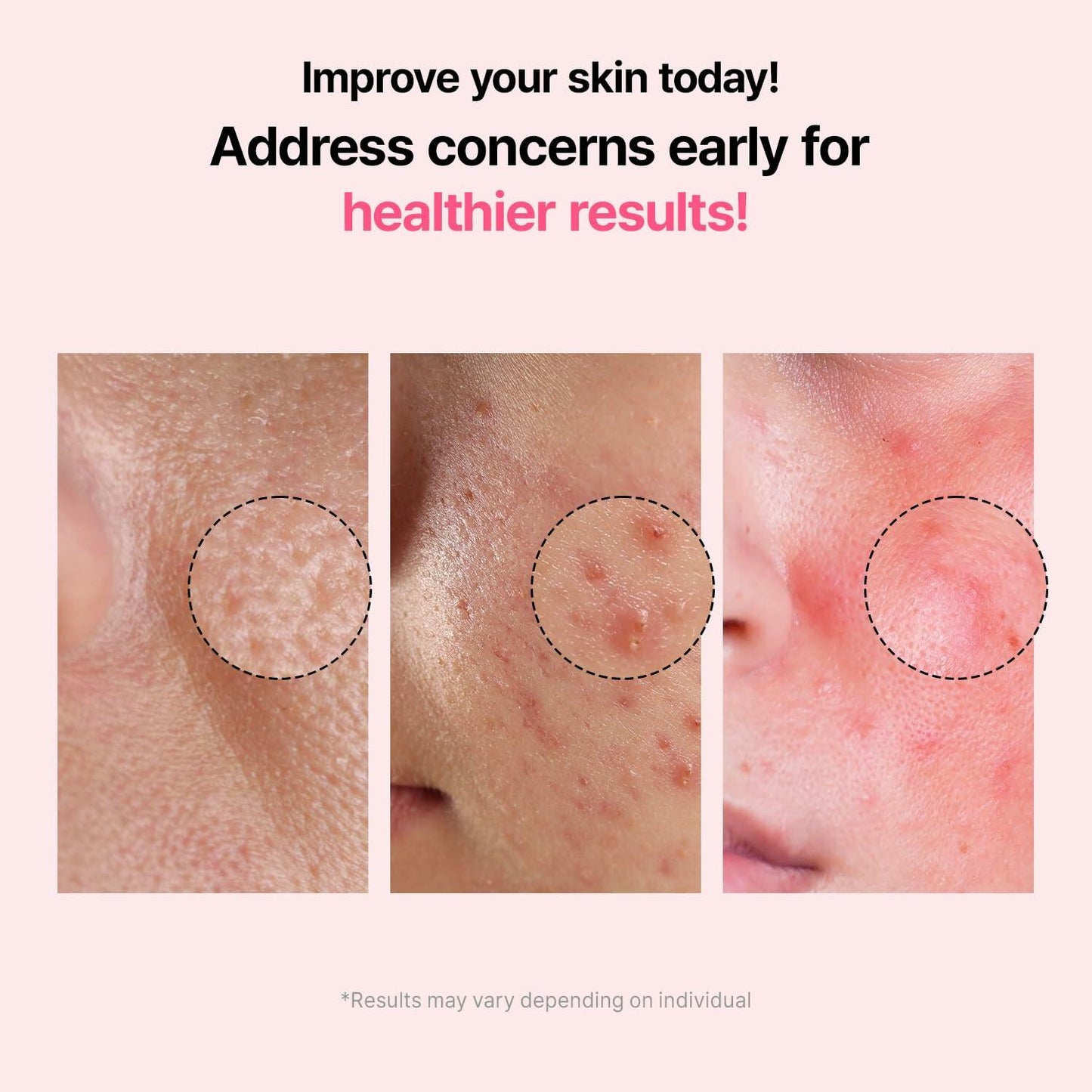 VEGANIFECT Pore Refining Ampoule Tightening Reduce Sebum 1.69oz